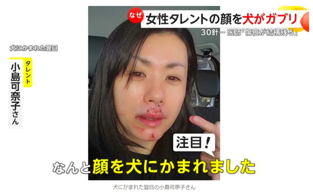 小島可奈子 犬 噛まれた FNN