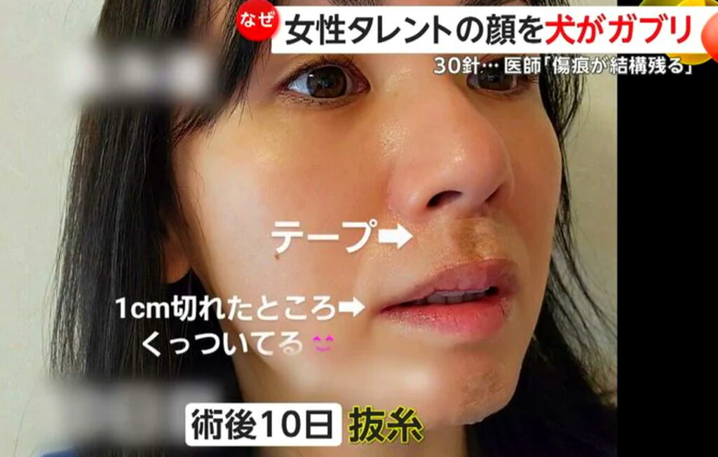 小島可奈子 犬 噛まれた FNN