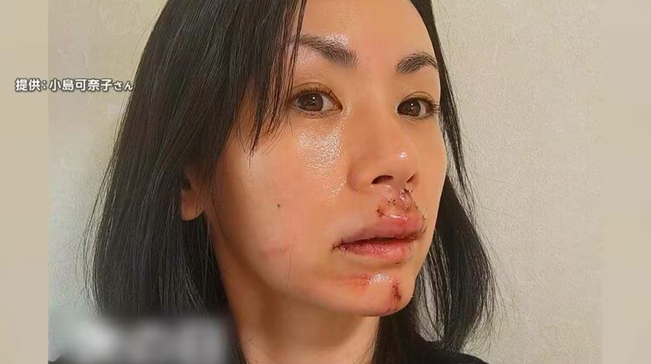 小島可奈子 犬 噛まれた FNN