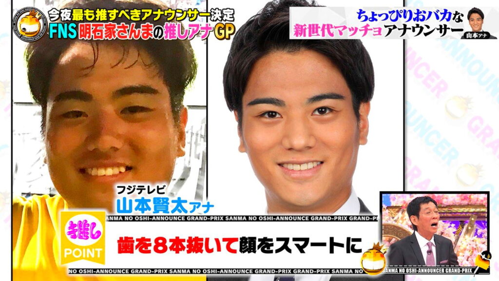 山本賢太アナ 整形 歯抜き FNS